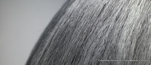 University Study Says It’s True: Stress Does Turn Hair Gray (And It’s Reversible)
